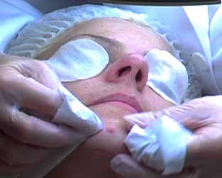 Extraction Facial