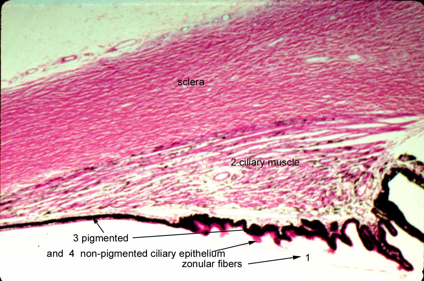 Pars Plicata And Pars Plana