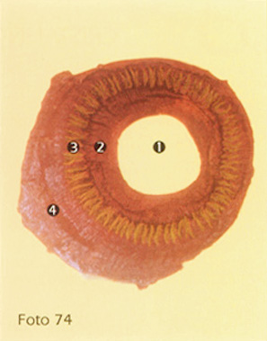 Pars Plicata And Pars Plana