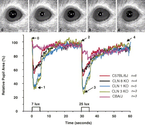 Pupillary Light Reflex Contralateral