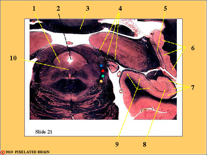 Pupillary Light Reflex Contralateral