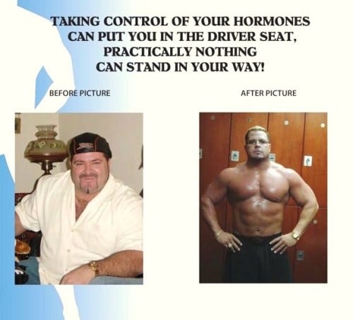 Testosterone Replacement Therapy Options