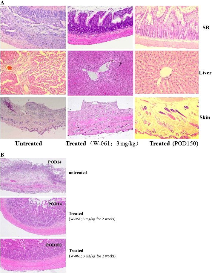 Gvhd Gut Symptoms