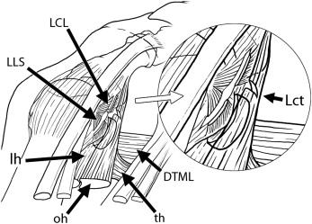 Hallux Valgus Deformity And Prevention