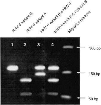 Hhv 6 Pcr