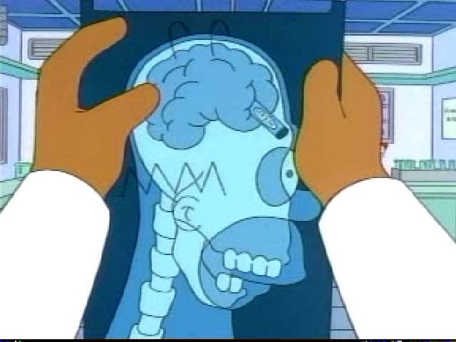 Homer Simpson Brain Picture