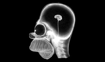 Homer Simpson Brain X Ray
