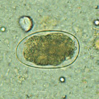 Hookworm Eggs