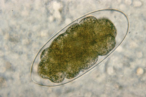 Hookworm Eggs Size