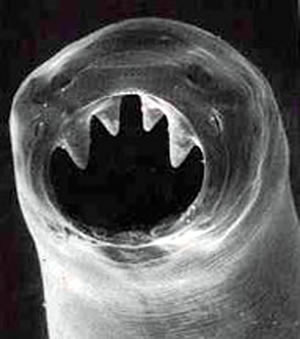 Hookworm Symptoms