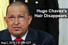 Hugo Chavez Cancer Pics