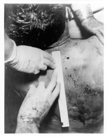 Jfk Autopsy Photos