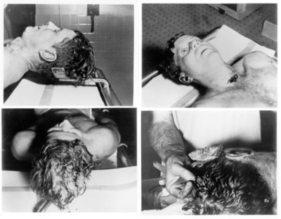 Jfk Autopsy Photos Real