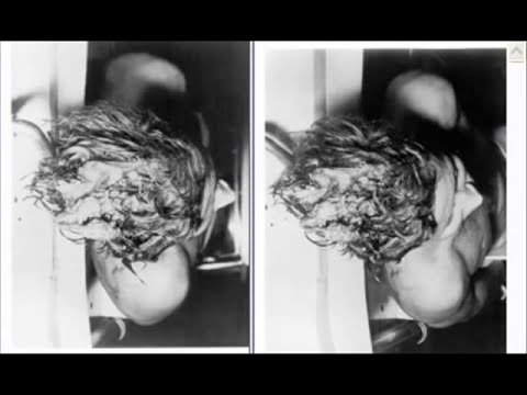 Jfk Autopsy Pictures Released