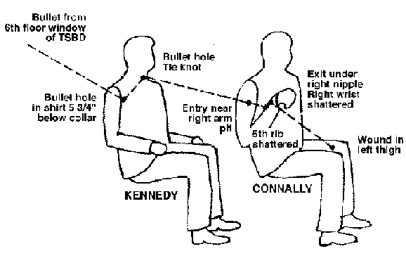 Jfk Shot Diagram