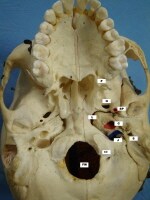 Jugular Foramen