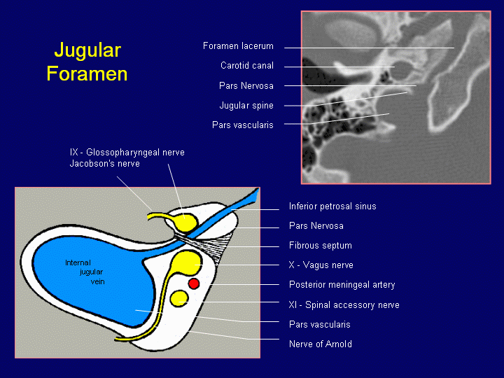 Jugular Foramen