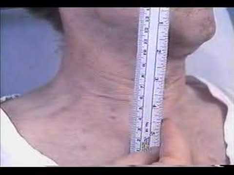 Jugular Venous Pressure