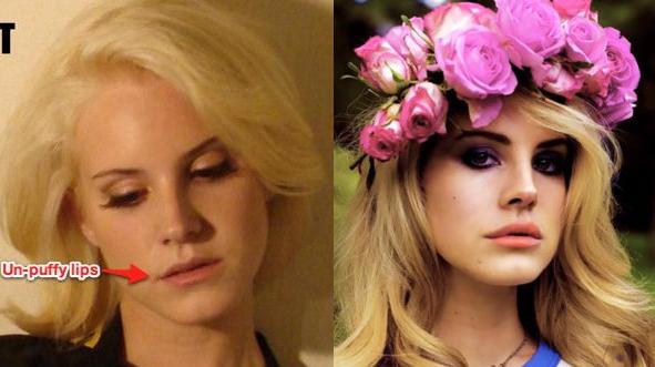 Lana Del Rey Before And After Surgery