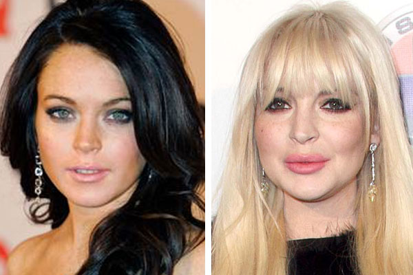 Lindsay Lohan Before And After Plastic Surgery 2012