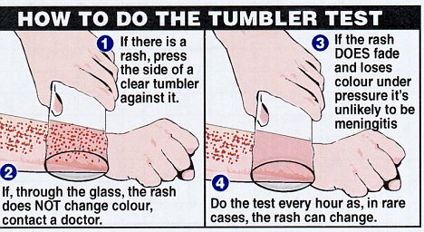 Meningitis Baby Rash Pictures