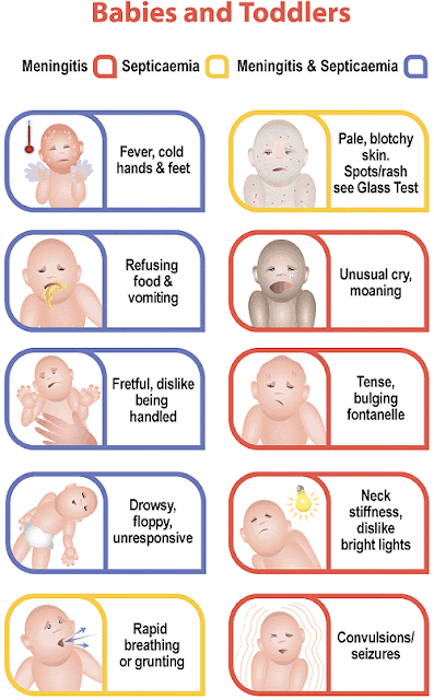 Meningitis Baby Symptoms