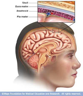 Meningitis Symptoms Pictures