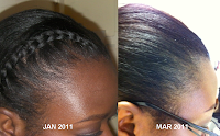 Mn Hair Growth 2012