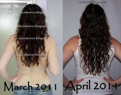 Mn Hair Growth Results