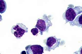 Nk Killer Cells Test