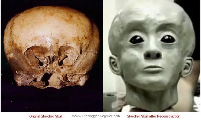 Skull Reconstruction