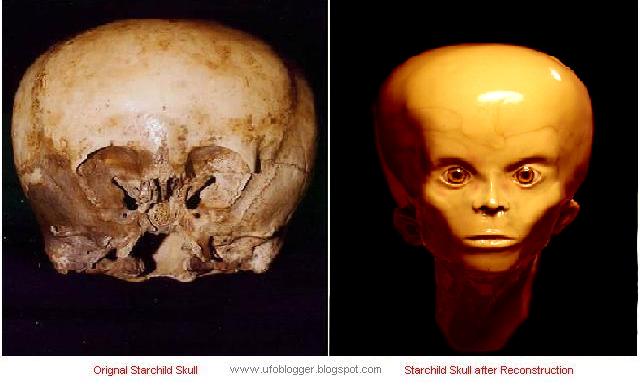 Starchild Skull Reconstruction