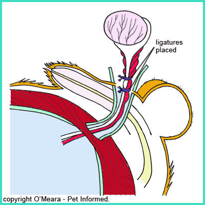 Testicles Removed At Birth