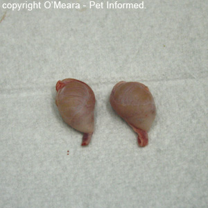 Testicles Removed At Birth