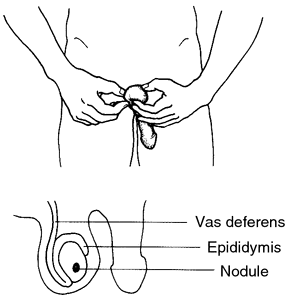 Testis Definition