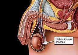 Testis Definition