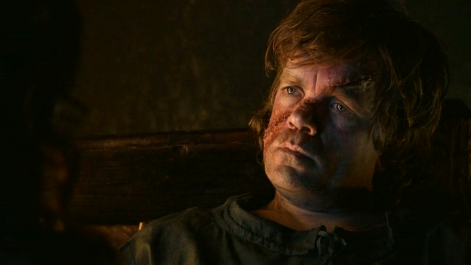 Tyrion Lannister Scar